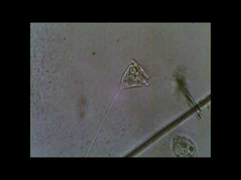 When Stylonychia met Vorticella
