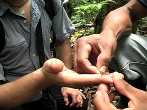 Healing Seekers - Army Surgery Ant and Stitches