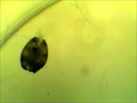 Ostracod