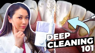 What is a DEEP TEETH CLEANING and WHY do you need one?