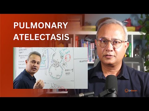 Pulmonary Atelectasis