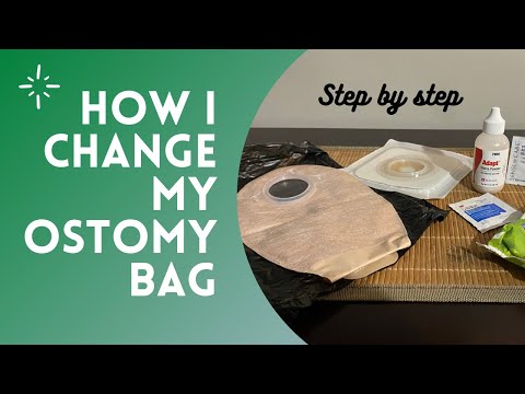 Changing My #Ostomy Bag | #ConvaTec | Step by Step VISUAL