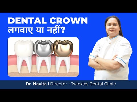 Dental Crown लगवाए या नहीं? I Dental Crown के नुकसान क्या है? I Dr. Navita