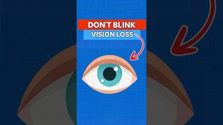 This Is How Vision Slowly Disappears  #science #knowledge