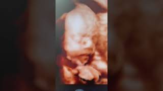 5d scan baby