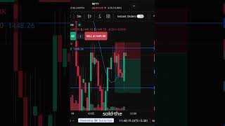 Day 102  #trading#24jeevan #stockmarketindia #stockmarket @Mynameis24-sk6lh #trendingshorts