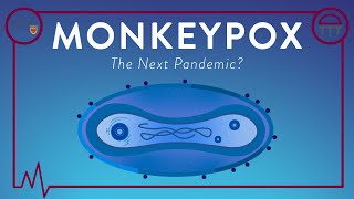 #Shorts - Monkeypox