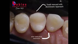 Biomimetic Dentistry Philippines