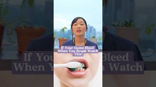 Gums bleeding while brushing? Watch this!