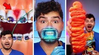 Which TikTok Will Break my Braces !?