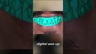 #digitalsmiledesign #chennaidentist #smiledentist #smilemakeover #drarunsuraj