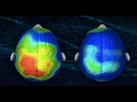Cientistas descobrem música contra ansiedade .
