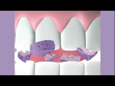 QuickDetect Plaque Disclosing Products