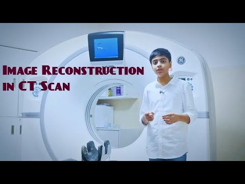 Image Reconstruction in CT Scan - History of Science by Surya & Teja
