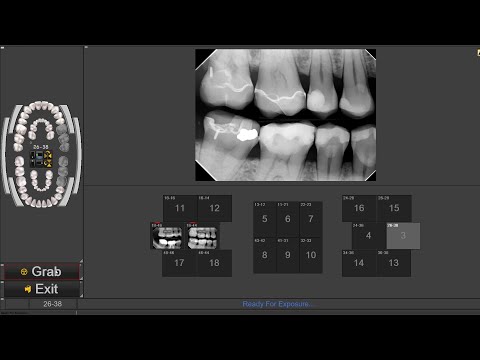 How to acquire patient x-rays in CADI