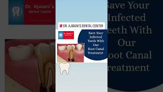 #rootcanal #rct #dentistry #dentist #endodontics #rootcanaltreatment #dental  #rootcanalspecialist