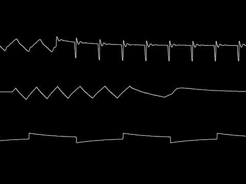 [C64] Badger Mushroom Snake (Badgers SID cover) – oscilloscope view