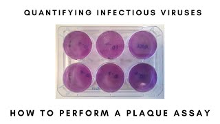 How to Perform a Plaque Assay