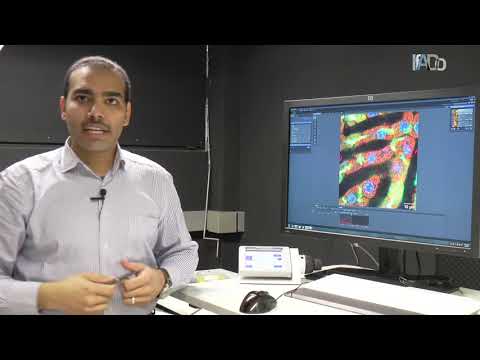 Intravital imaging of cholestatic livers in mice