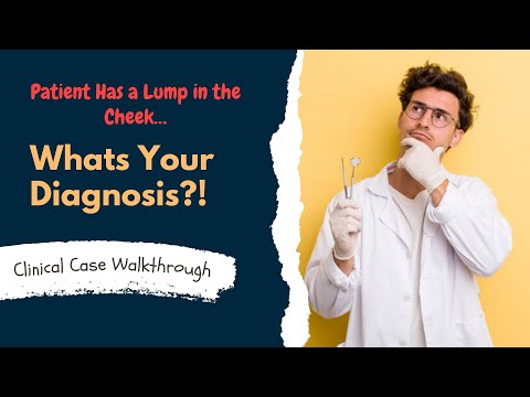Oral Lesion That Looks Innocent… But Is It?