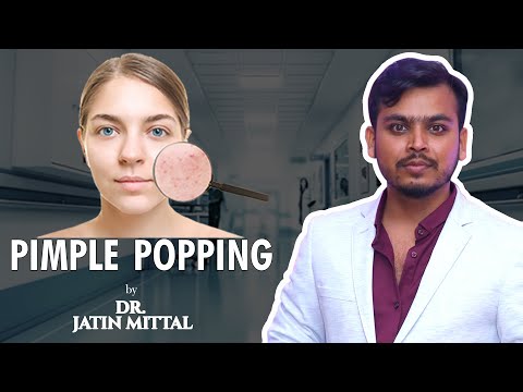 how to remove pimple-popping- By Dr. Jattin Mittal