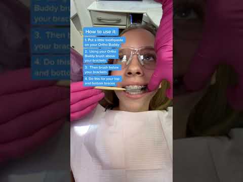A #dentist shows her orthodontic patient how to brush with #braces #shorts