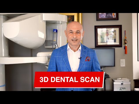 3D Dental Scan