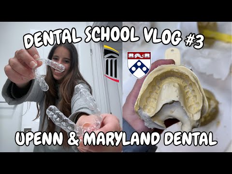 Dental School VLOG #3 | Retainers, Midterms, etc.