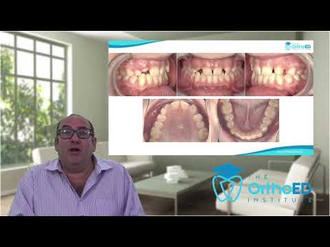 Webinar   1 The case for orthodontics in a general dental practice