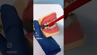 Did you know the proper technique to brush your teeth? #dentalhealth #dentalhygiene