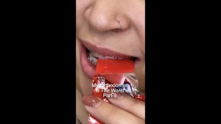 So What CAN You Eat With Braces? 😩