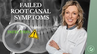 Warning Signs Your Root Canal Failed: Should You Get A Root Canal?