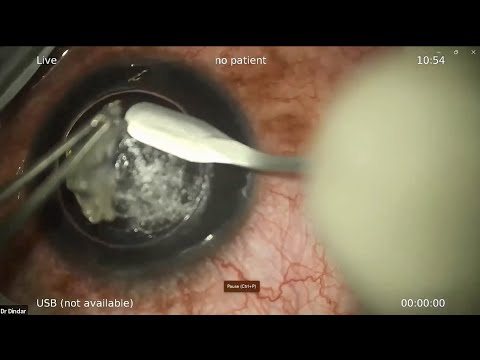 Community Eye Health Webinar - Surgical Mentorship