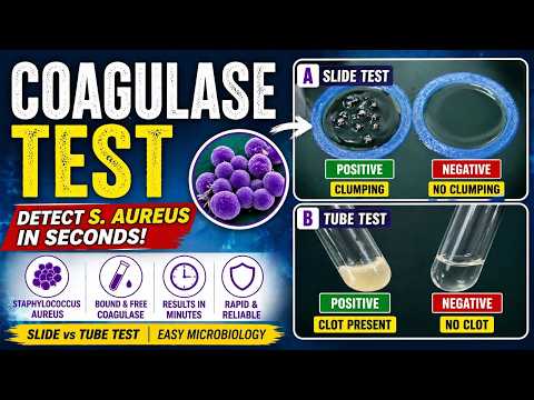 Coagulase Test Explained | Slide vs Tube Test (S.Aureus Detection)#microbiology #test #labtechnician
