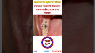 दातांमध्ये कीड लागलेली असेल तर दातांवर काय लावावे | General knowledge quiz | #shorts #trivia #gk