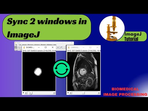 Sync 2 windows in ImageJ | Tutorial
