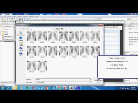 Recognizing Common CT Imaging Signs of  Lung Diseases through a New Feature Selection  Method