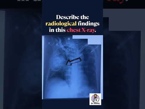 Can you identify the abnormality?