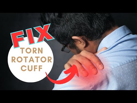 How to Fix a Torn Rotator Cuff: 16 Tips to Treat Shoulder Pain