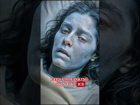 How Did This Woman Survive Being Frozen?