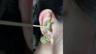 Massing Ears #earmassage #ear #earpick #EarCleaningRelaxing #earcleaning #earpicking #Asmr 2