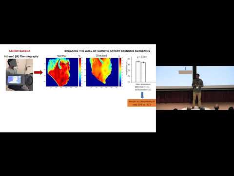 Falling Walls Lab Sg 2019 - Ashish SAXENA / Breaking the Wall of Carotid Artery Stenosis Screening