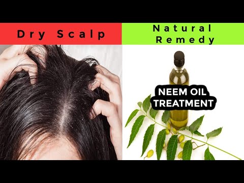 Dry Scalp Treatment | #Dry Scalp | #Neem Miracle Oil