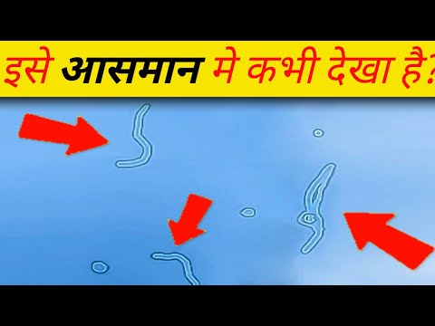 कभी इसको आसमान में देखा हैं ? | WHAT ARE THE SKY FLOATERS ?