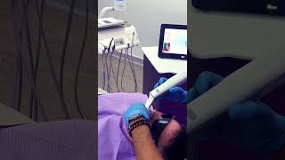 what is digital impression?🤳 #dentist   #youtubeshorts
