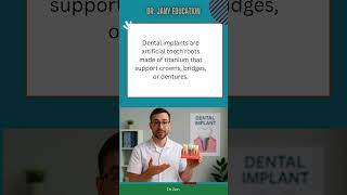 What Are Dental Implants? Explained in 60 Seconds 🦷"