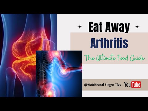 Eat Away Arthritis | The Ultimate Food Guide