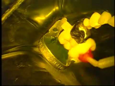 The Bioclear Method -  On Lay Seat