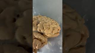 REAL Human Brain & Processing Vision!