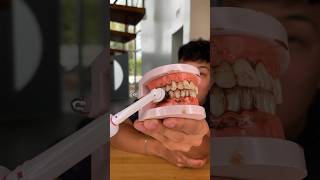 Testing Cheap vs. Expensive Toothbrushes!